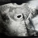 주진로 | [임신일기] ep2. 청주 신혼부부 산부인과 선택 리얼 후기 (하안유산부인과 결정 이유 + 초기 진료 경험...