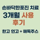 (주)한결11 | 손바닥한포진연고 사용한 태백한포진 친구 3개월 후기