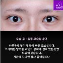비씨아이성형외과의원 이미지