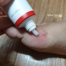 주식회사 세븐메디컬 | 아토피로션 아토큐브 크림!! 이렇게 효과가 좋을수가~~ 레알사용후기에요