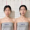 바디랩 | 부산 비대칭·윤곽관리 추천｜대신동 비체스킨앤바디랩 후기