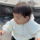 에스앤유서울병원 | 마포공덕 에스앤유피부과 / 인중 이마 코 연어반 치료 4-6회 후기 / 치료 끝!