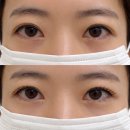 안양우체국 | 안양속눈썹펌 잘하는곳 단하래쉬 다녀온 솔직후기 - 자연스럽게 또렷한 눈매 완성