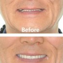 보람치과기공소 이미지