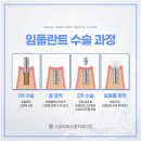 이레치과 이미지