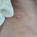 백일온누리약국 | 5개월아기 크림로션 후기 (쁘리마쥬,피지오겔,로로비앙,수도크림,비판텐)