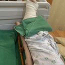 천안재활병원 | 천안센텀병원 인대파열 수술 후기｜4-7일차 현실 통증과 입원 기록😭