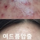 퓨어르떼(PURERTE) 네이버블로그