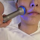 제일한방메디칼 | 결혼준비) 14. 웨딩촬영 일주일 전 &#34;티타늄리프팅&#34; (통증,전후비교,효과) 종로피부과 내돈내산 후기!!!