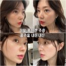 미사피부과의원 | 미사역피부과 내돈내산 눈밑콜라겐주사 콜라움 솔직후기