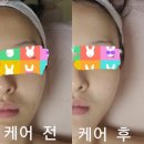 에스케어 이미지