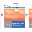 늘품피부샵