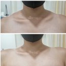 안제의원 | 남포동보톡스 제대로 알아봐야하는 이유