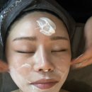 성북-길음-303 | 가인에스테틱에서 이지샷 테라피 받은 후기 출산 후 지친 피부에 생기를