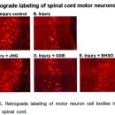 이상헌한의원 | 척수염 수술 후유증으로 걷지 못한지 반년, 신경 회복 한약 덕분에 두 발로 퇴원할 수 있었어요.
