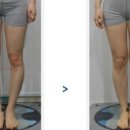 장한평역든든한정형외과의원 네이버블로그