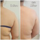 생명(조각) | 구리 피부샵 갈매동 '더 조각 테라피' 전신후면관리 10회 후기 '스물일곱'