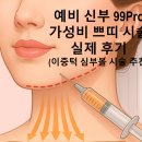 예산(대전) | 대전 예비신부 피부과 시술 후기, 100만원 예산으로 받은 시술 솔직 후기