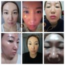 인셀덤메인 네이버블로그