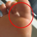 구은사 | 발 굳은살 제거 연고, 각질 관리하는 필수 팁 (지금 확인!)