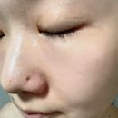 피지완화제 추천 혐짤주의 코피지 블랙헤드 녹여 없앤 아나시스 피지연화제 솔직후기
