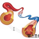 경동맥 혈관의 철저한 관리로 뇌질환 예방 이미지