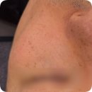 중부대로 | 용인 삼가동 피부관리, 남자도 만족한 모공청소 후기 ; 올가드림뷰티 삼가점