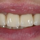 엠웍스 치과기공소 이미지