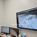 평촌자연과한의원 | 40대후반 남성, 평촌나우병원 회전근개 수술 후기