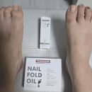 베어네일(Bear nail) | 미사 라디앙네일에서 시작한 발톱무좀 케어 솔직후기^^