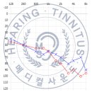 드림보청기 이미지