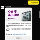 스마일 | 광주 신세계안과 스마일 라식 후기