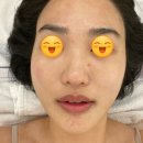 가림피부관리 이미지