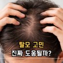 케라넷 효능 탈모 영양제 고민이라면? 가격부터 부작용까지 확인하세요