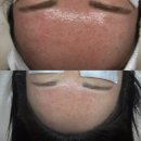 뷰티헤어&쟝 | 추천하는 상봉피부관리, 리브르 에스테틱 스킨플래닝 세라링 물방울관리 후기 – 무너진 피부 진정 성공 🫧