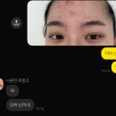 송화로48번길 10 | [청주 에스테틱 스킨플래닝] 유앤데이 웨딩·신부 피부 관리받고 깐복숭아 된 후기