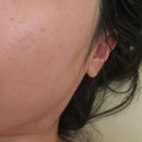 경희광교호수한의원 | 신년다이어트 봄다이어트 광교다이어트 케어포랩 솔트점 상담 및 관리후기