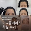 청주 잘하는 왁싱샵 추천&amp; 후기(미니풀페이스- 헤어, 이마, 구렛나루): 미헤브 왁싱