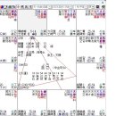 명반연구실 2170 출산후 뇌경색 이미지