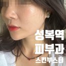 수지 성복역 피부과 레스노베 크리스탈 스킨부스터 트러블 박멸 후기