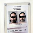 발로 | 위뷰티 턱쉐딩 피부관리 발로 받는 윤곽관리 후기
