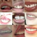 엔젤 | 리버스 엔젤바이트 엔젤 팽 피어싱 후기