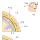 경막하 출혈 (acute subdural hemorrhage) 이미지