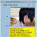 밝은귀보청기 이미지