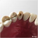 상아플란트치과 이미지