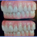 동행치과기공소 이미지