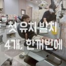 유치 | 둘째 유치 발치 후기｜처음 발치로 4개를 뽑았던, 엄마의 기록