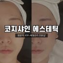 관리 잘하는 곳 &#39;코지샤인 에스테틱&#39; : 내돈내산 얼굴(물방울 초음파)+등 관리 후기 : 프랑스 탈라...