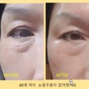 미라클 테라피