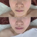 샘아쿠아라인 | 구리 피부관리 뷰티엔제이 신부관리 추천 바디라인,얼굴라인 달라진 1회 관리 후기